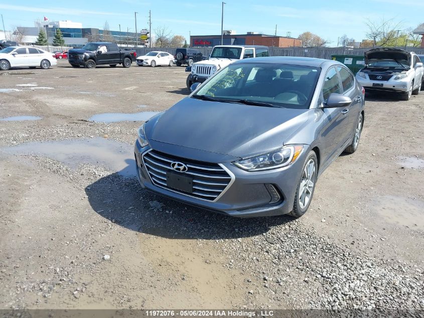 2017 Hyundai Elantra VIN: KMHD84LF5HU110897 Lot: 11972076