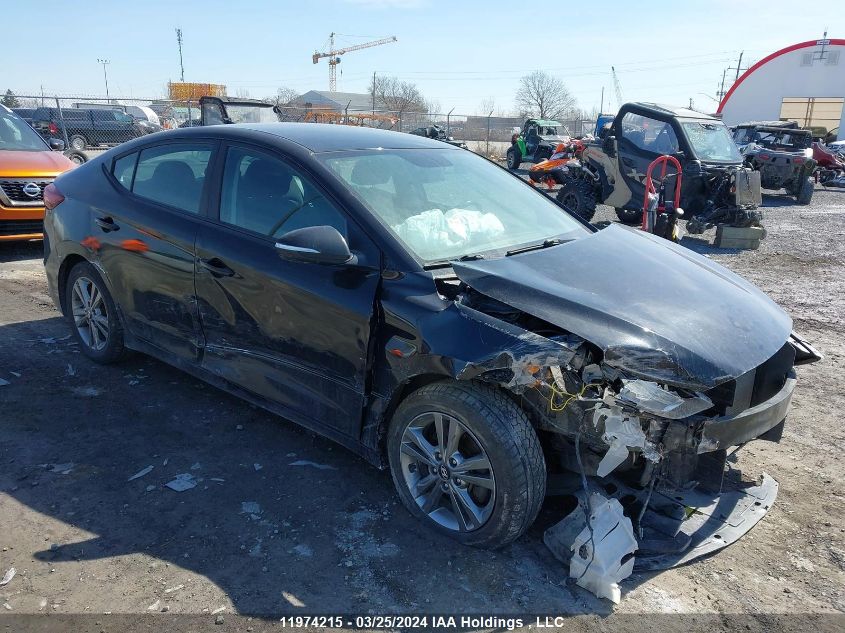 2017 Hyundai Elantra VIN: KMHD84LF1HU300535 Lot: 11974215