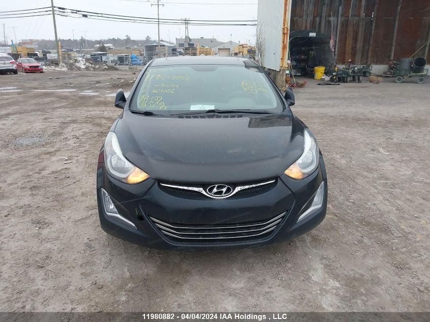 2016 Hyundai Elantra VIN: KMHDH4AE2GU569166 Lot: 11980882