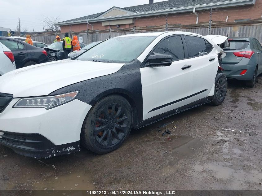 2015 Acura Tlx VIN: 19UUB1F31FA801835 Lot: 11981213