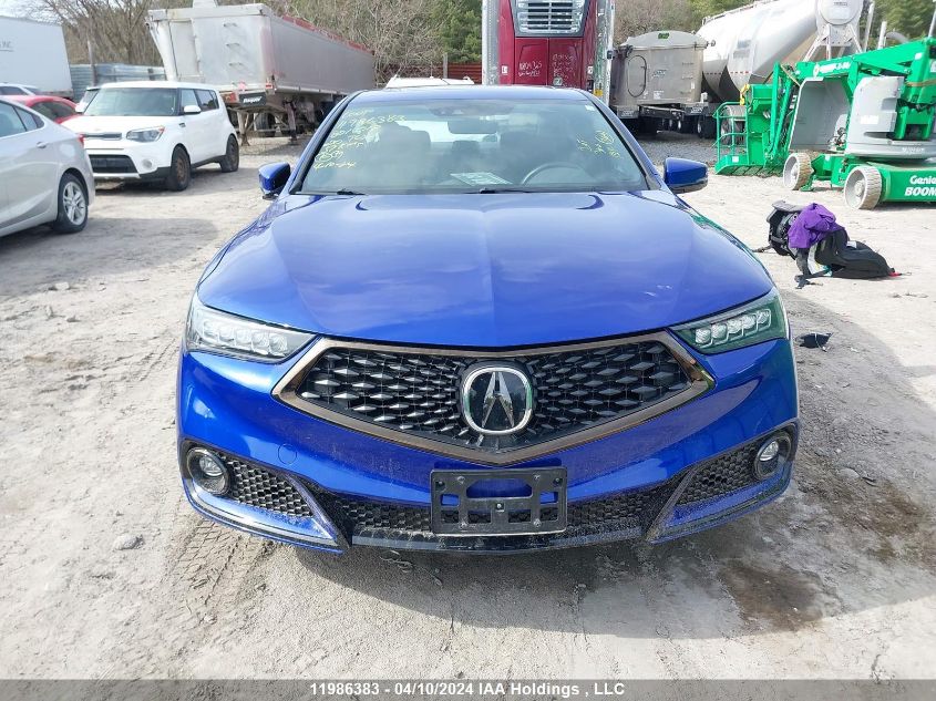 2020 Acura Tlx VIN: 19UUB1F65LA801018 Lot: 11986383