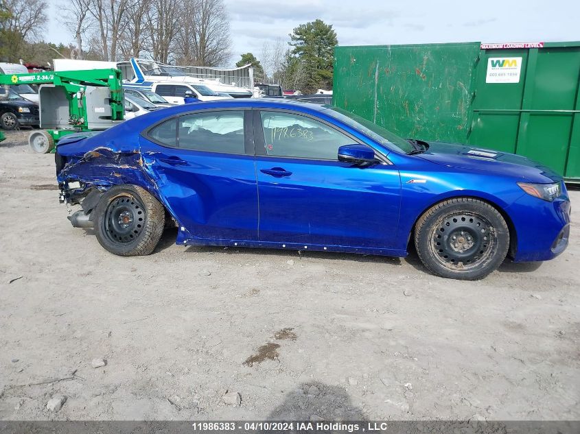 2020 Acura Tlx VIN: 19UUB1F65LA801018 Lot: 11986383