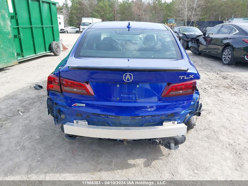 2020 Acura Tlx VIN: 19UUB1F65LA801018 Lot: 11986383