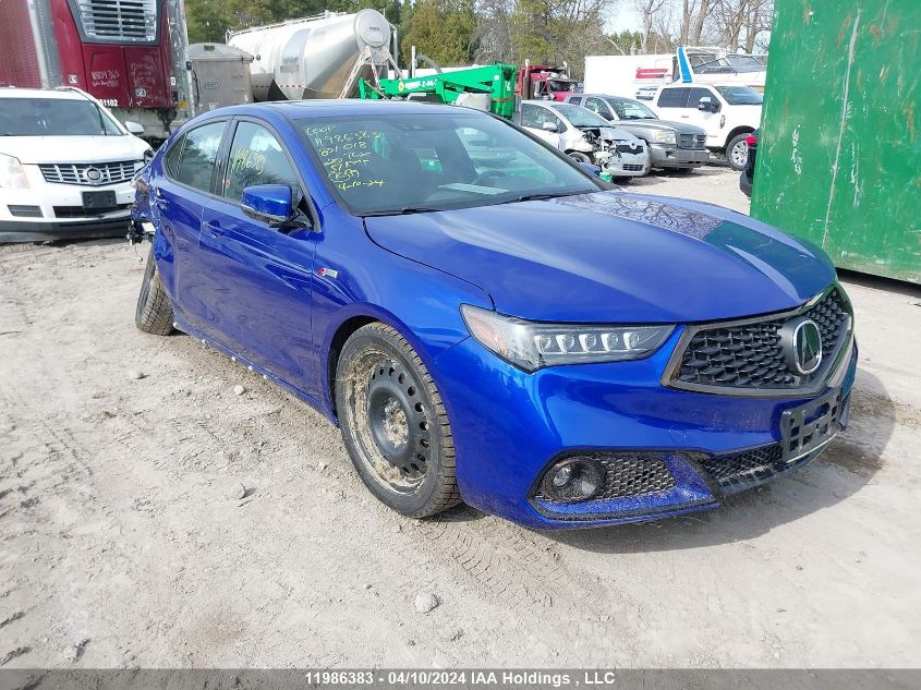 2020 Acura Tlx VIN: 19UUB1F65LA801018 Lot: 11986383