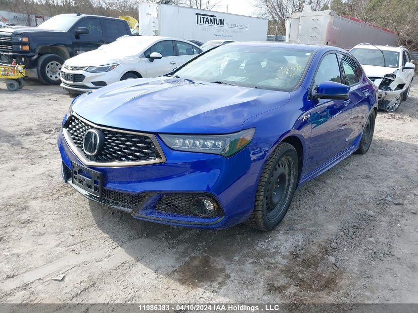 2020 Acura Tlx VIN: 19UUB1F65LA801018 Lot: 11986383