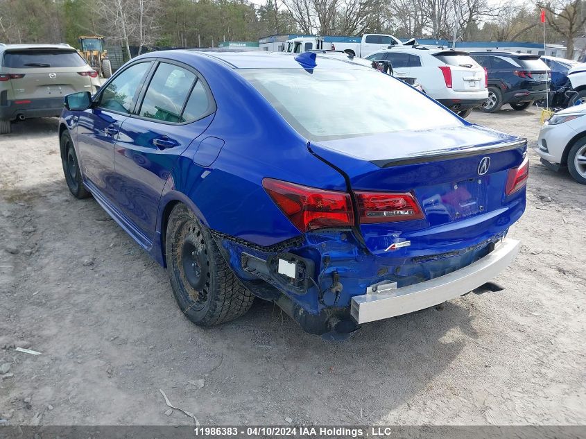 2020 Acura Tlx VIN: 19UUB1F65LA801018 Lot: 11986383