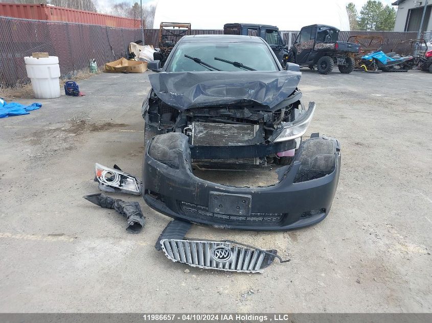 2011 Buick Lacrosse VIN: 1G4GC5EDXBF306360 Lot: 11986657