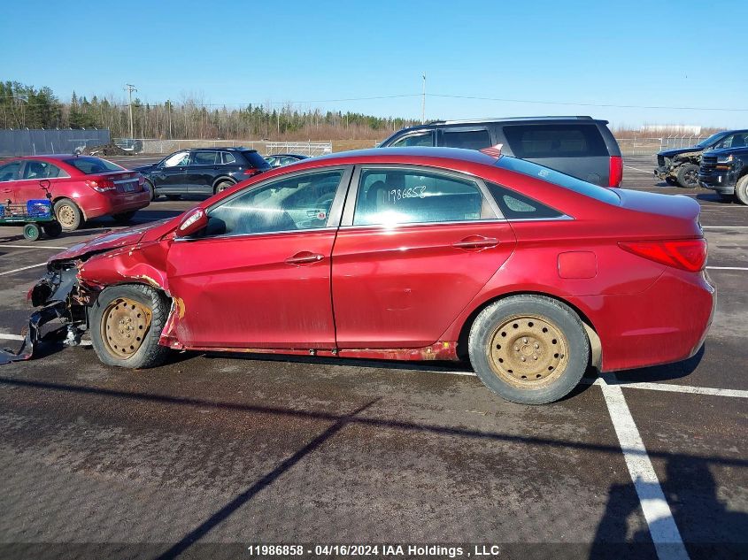 2014 Hyundai Sonata Gls VIN: 5NPEB4AC8EH873487 Lot: 11986858