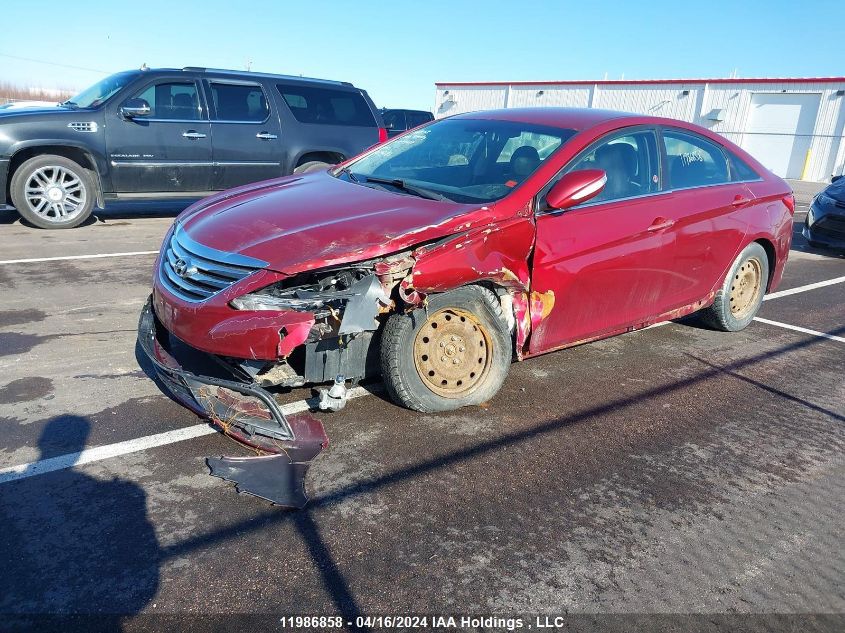 2014 Hyundai Sonata Gls VIN: 5NPEB4AC8EH873487 Lot: 11986858