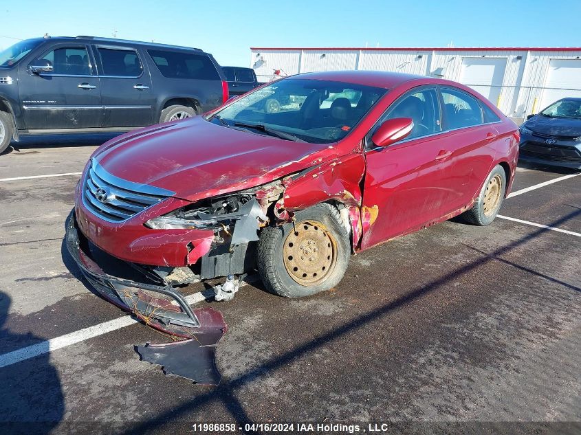 2014 Hyundai Sonata Gls VIN: 5NPEB4AC8EH873487 Lot: 11986858