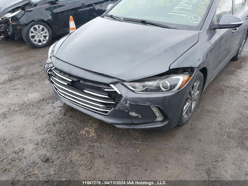 2017 Hyundai Elantra VIN: KMHD84LF7HU091771 Lot: 11987270