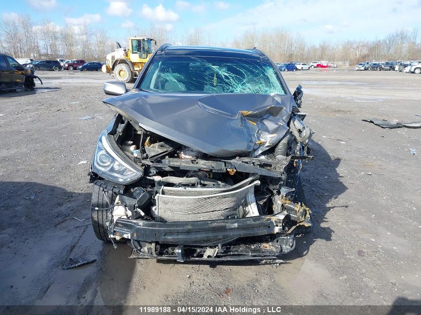 2017 Hyundai Santa Fe Sport 2.4 Se VIN: 5NMZUDLB5HH044829 Lot: 11989188