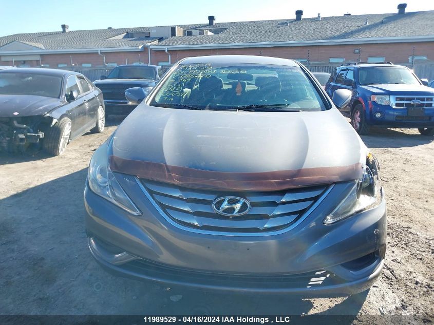 2011 Hyundai Sonata VIN: 5NPEB4AC9BH056220 Lot: 11989529