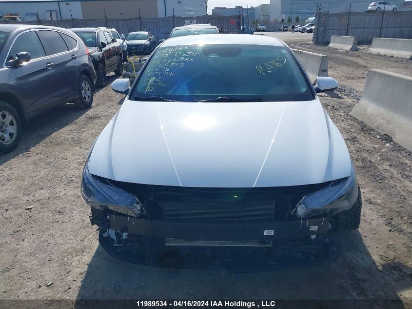 2022 Hyundai Elantra Preferred Ivt VIN: KMHLM4AG5NU215843 Lot: 11989534