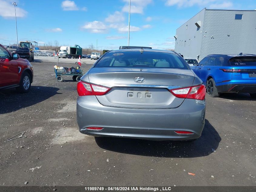 2011 Hyundai Sonata VIN: 5NPEB4AC0BH259819 Lot: 11989749