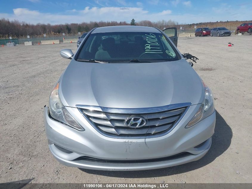 2013 Hyundai Sonata VIN: 5NPEB4AC5DH623722 Lot: 11990106