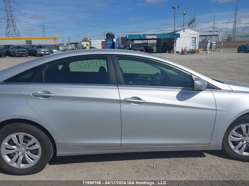 2013 Hyundai Sonata VIN: 5NPEB4AC5DH623722 Lot: 11990106