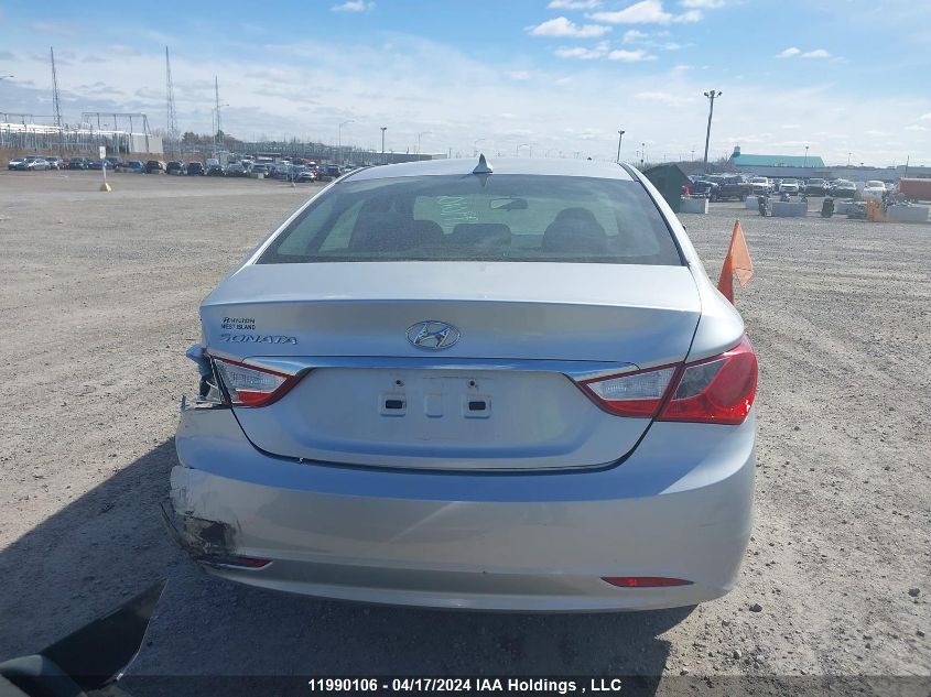 2013 Hyundai Sonata VIN: 5NPEB4AC5DH623722 Lot: 11990106