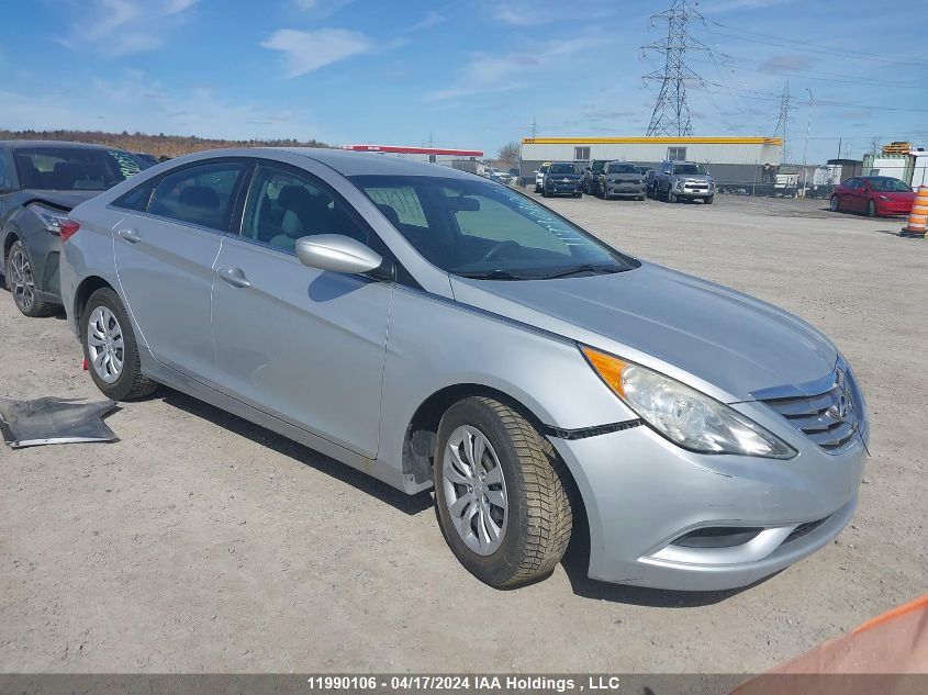 2013 Hyundai Sonata VIN: 5NPEB4AC5DH623722 Lot: 11990106