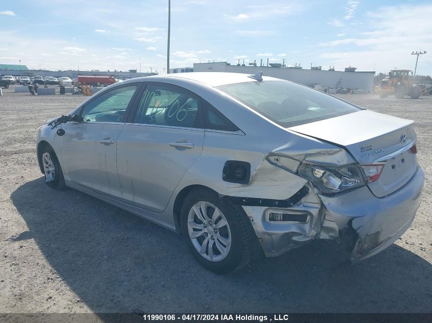 2013 Hyundai Sonata VIN: 5NPEB4AC5DH623722 Lot: 11990106