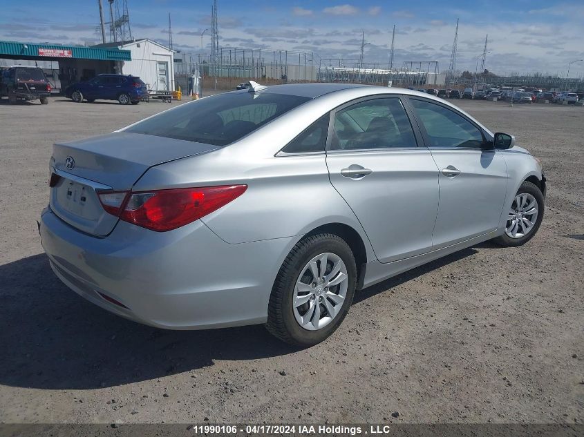 2013 Hyundai Sonata VIN: 5NPEB4AC5DH623722 Lot: 11990106