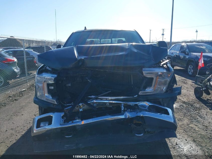 2018 Ford F-150 VIN: 1FTFW1E57JFE28407 Lot: 11990482