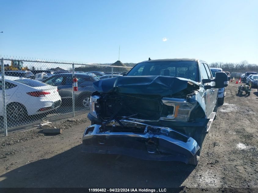 2018 Ford F-150 VIN: 1FTFW1E57JFE28407 Lot: 11990482