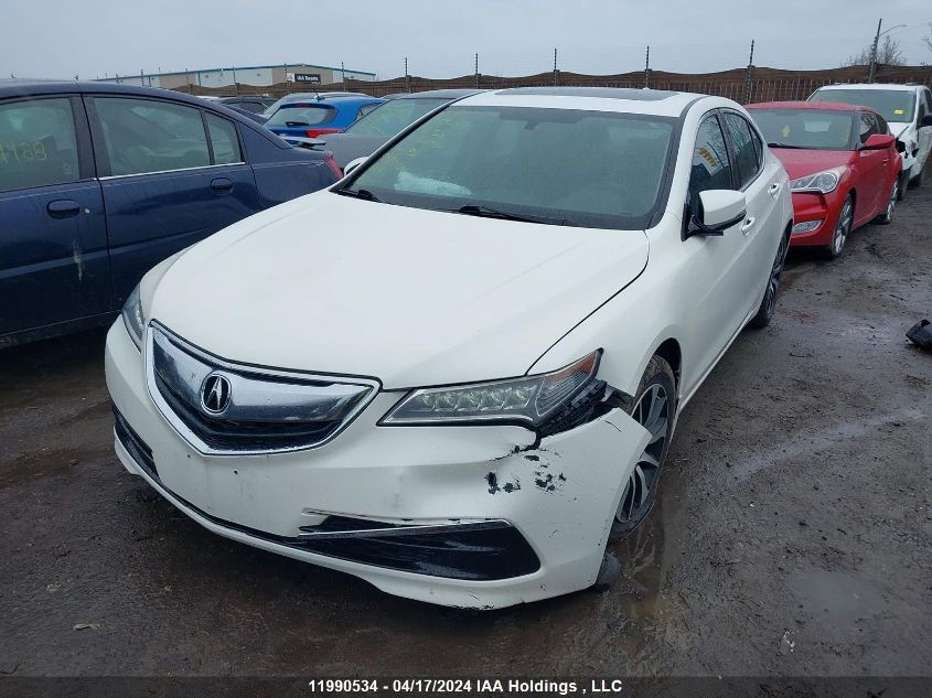 2016 Acura Tlx VIN: 19UUB1F37GA800559 Lot: 11990534