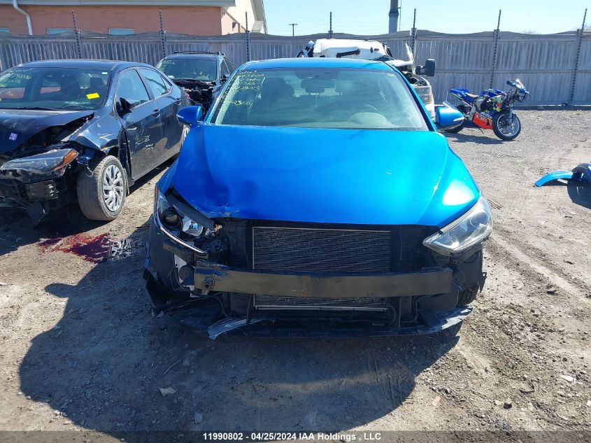 2017 Hyundai Elantra VIN: KMHD84LF5HU117722 Lot: 11990802