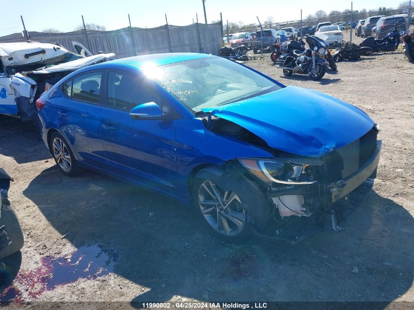 2017 Hyundai Elantra VIN: KMHD84LF5HU117722 Lot: 11990802