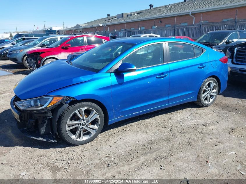 2017 Hyundai Elantra VIN: KMHD84LF5HU117722 Lot: 11990802