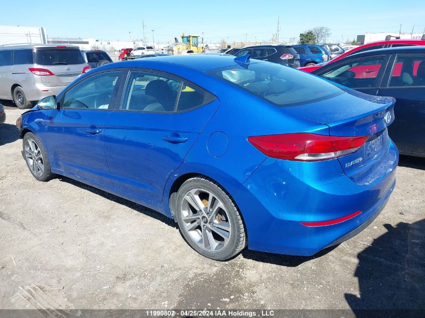 2017 Hyundai Elantra VIN: KMHD84LF5HU117722 Lot: 11990802