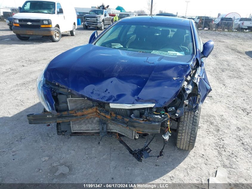 2013 Hyundai Sonata Gls VIN: 5NPEB4AC9DH530539 Lot: 11991347