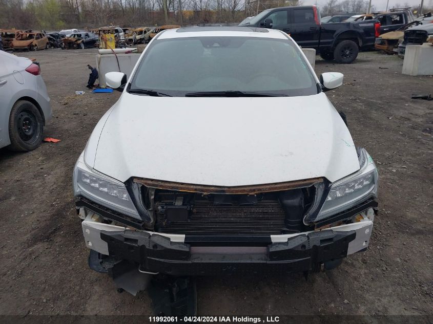 2017 Acura Ilx VIN: 19UDE2F84HA800416 Lot: 11992061