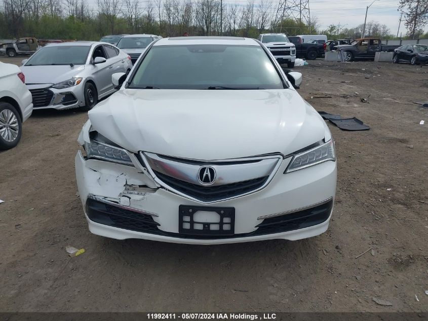 2016 Acura Tlx VIN: 19UUB1F56GA800196 Lot: 11992411