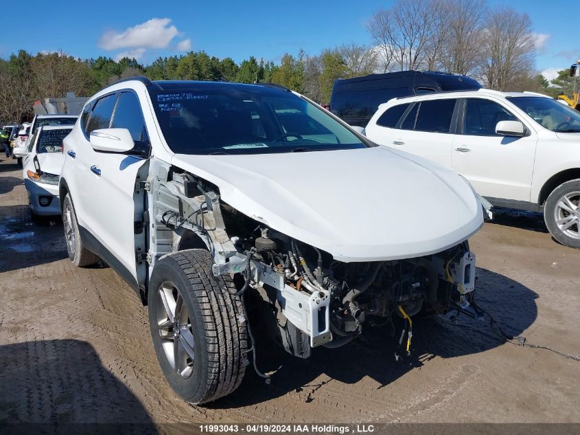 2017 Hyundai Santa Fe Sport VIN: 5XYZUDLB1HG415270 Lot: 11993043