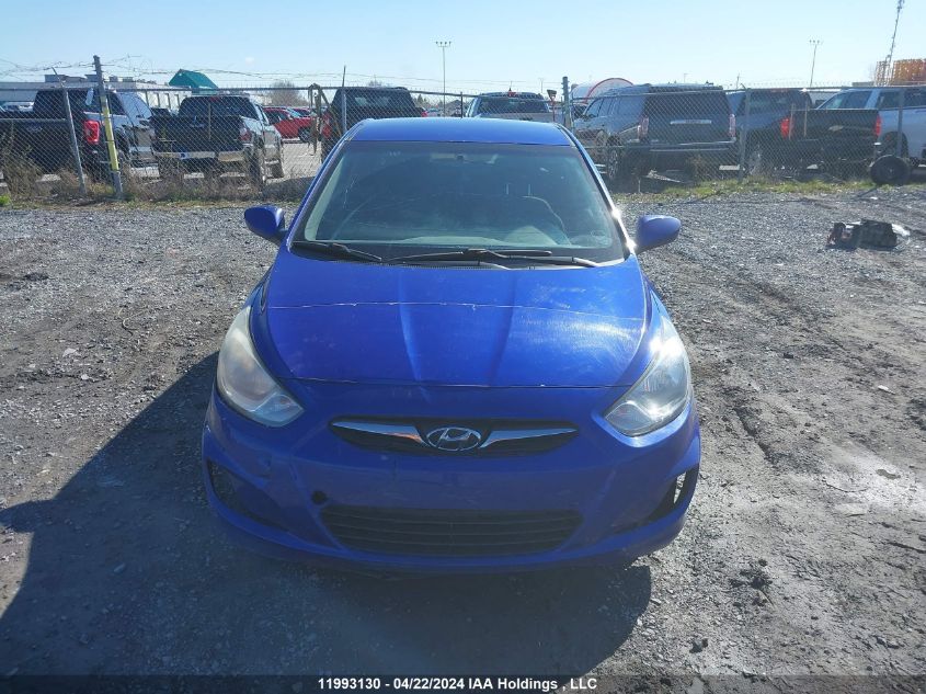 2013 Hyundai Accent Gls/Gs VIN: KMHCT5AE5DU094284 Lot: 11993130