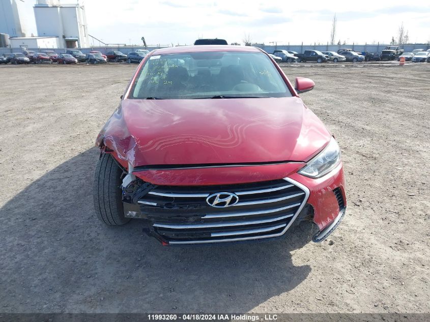 2017 Hyundai Elantra Se VIN: 5NPD74LF6HH132876 Lot: 11993260