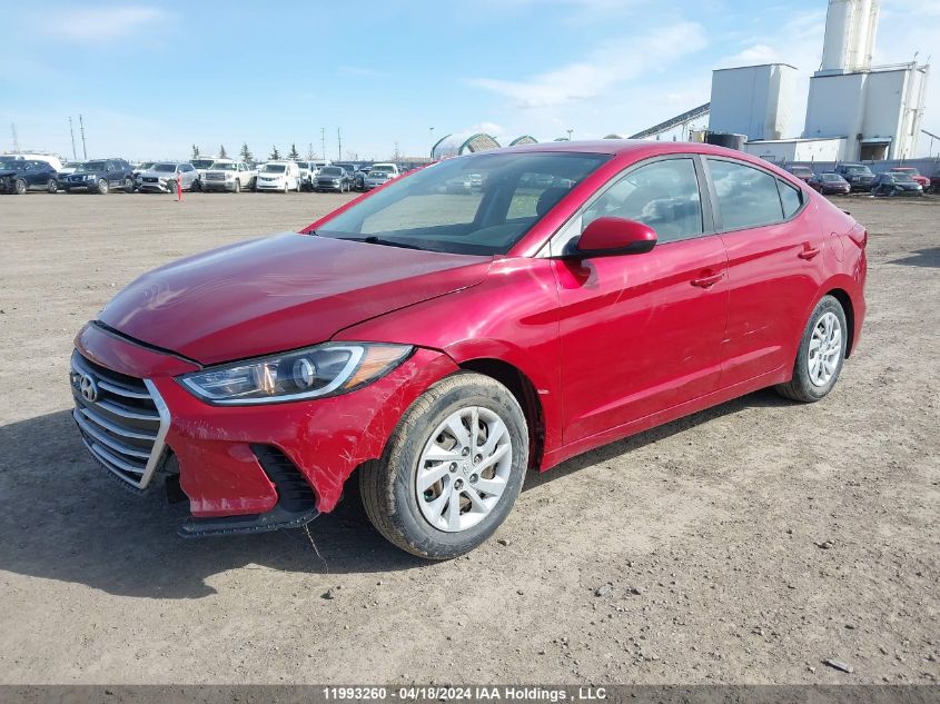 2017 Hyundai Elantra Se VIN: 5NPD74LF6HH132876 Lot: 11993260