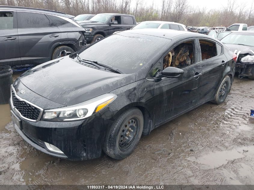 2017 Kia Forte VIN: 3KPFL4A72HE116856 Lot: 11993317