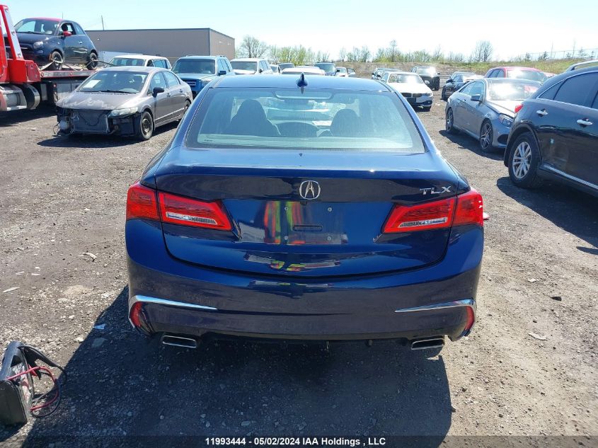 2018 Acura Tlx VIN: 19UUB1F5XJA800838 Lot: 11993444