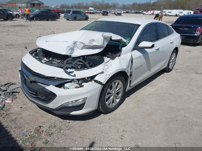 2020 Chevrolet Malibu VIN: 1G1ZD5ST5LF104199 Lot: 11993698