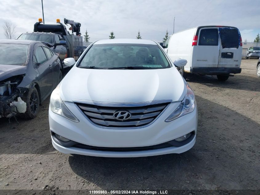 2014 Hyundai Sonata Gls VIN: 5NPEB4ACXEH890520 Lot: 11995983