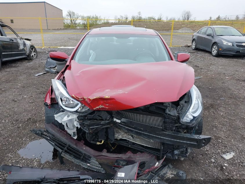 2014 Hyundai Elantra Se/Sport/Limited VIN: 5NPDH4AE9EH518372 Lot: 11996775