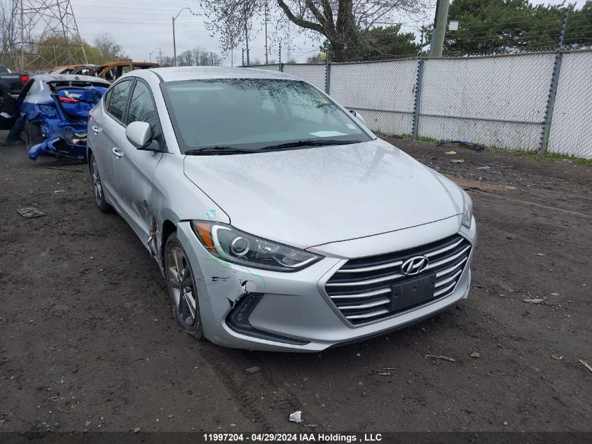 2017 Hyundai Elantra Se/Value/Limited VIN: KMHD84LF4HU133149 Lot: 11997204