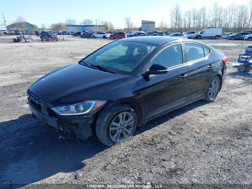 2017 Hyundai Elantra VIN: KMHD84LF7HU324628 Lot: 11997464