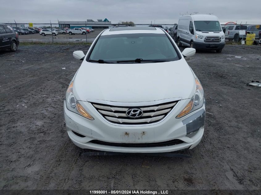 2013 Hyundai Sonata Se/Limited VIN: 5NPEC4AC8DH723715 Lot: 11998001