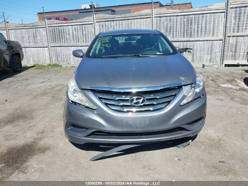 2011 Hyundai Sonata Gls VIN: 5NPEB4AC1BH277441 Lot: 12000299