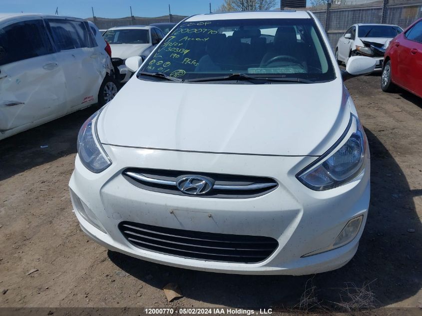 2017 Hyundai Accent Se VIN: KMHCT4AE3HU303134 Lot: 12000770