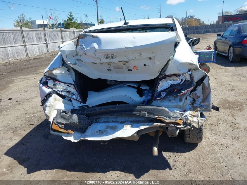 2017 Hyundai Accent Se VIN: KMHCT4AE3HU303134 Lot: 12000770